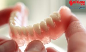 Trồng răng giả bao lâu hoàn thành với từng phương pháp?