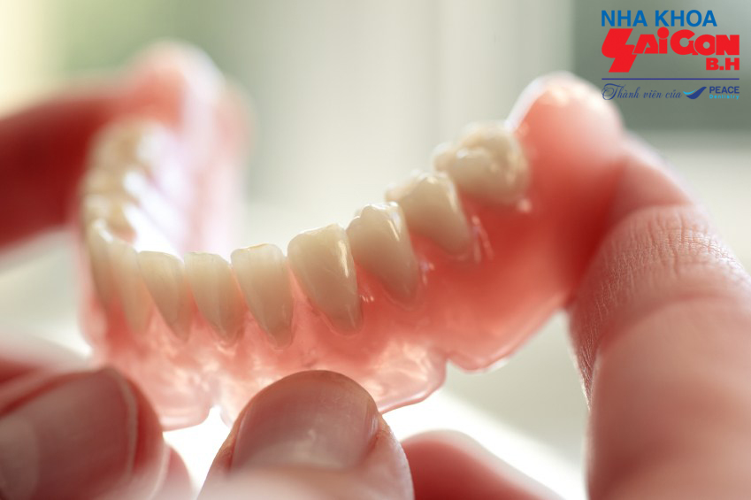 Trồng răng giả bao lâu hoàn thành với từng phương pháp?