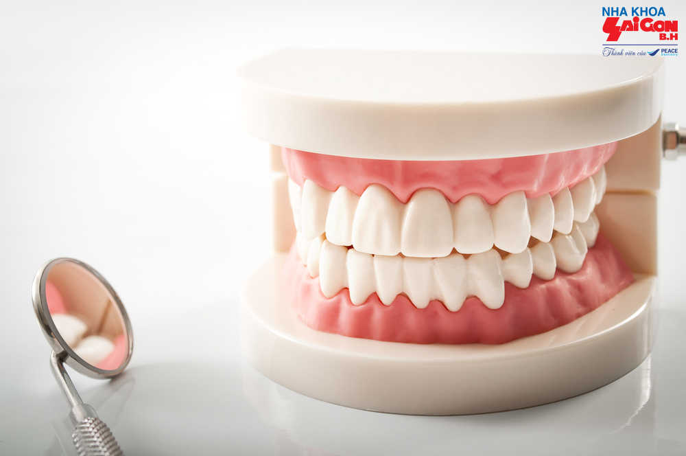 Trồng răng cửa có đau không và những điều bạn cần biết