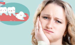 Nhổ răng khôn có đau không ?