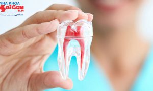 Những điều cần biết trước khi tiến hành chữa tủy răng