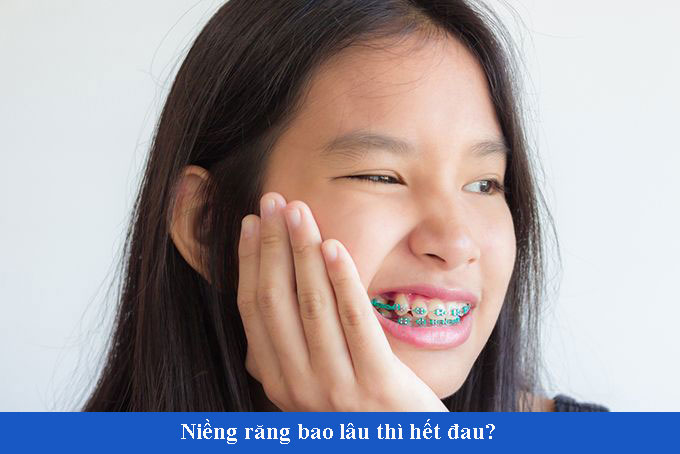 Niềng răng bao lâu mới hết đau – Khắc phục đau răng khi niềng