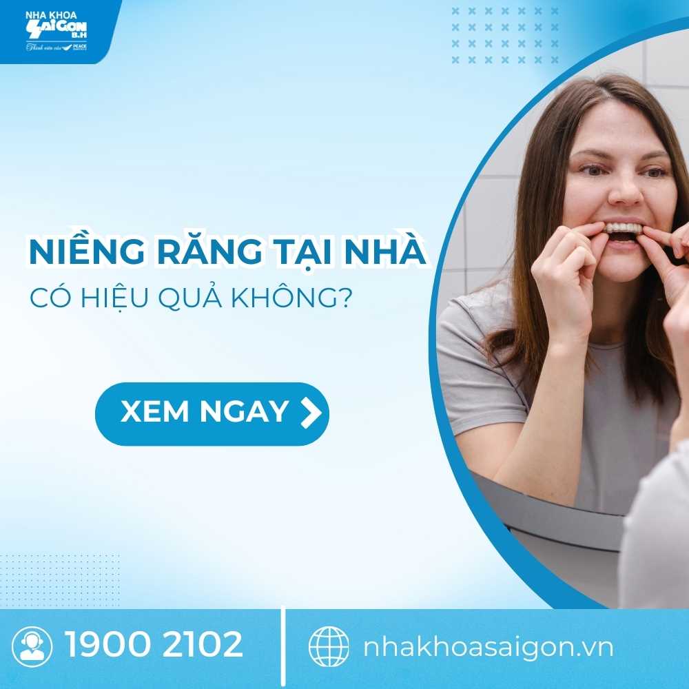 Niềng răng tại nhà có hiệu quả không? Cần lưu ý những gì?