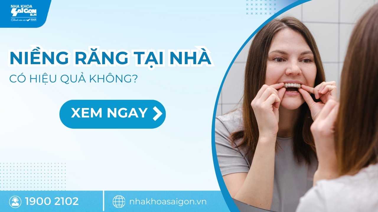 Niềng răng tại nhà có hiệu quả không?